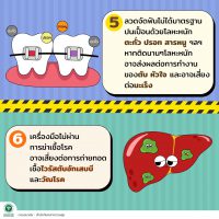 info641_tooth_10_5