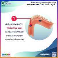 info687_tooth_13_3
